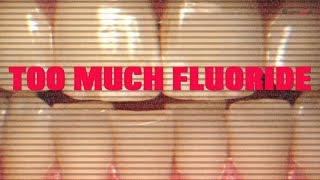 Dental Fluorosis On The Rise