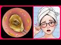 [ASMR] Top Student's Earwax Care!👂Eardrum Healing Spa in the Temple of Healing 🌿 thumbnail