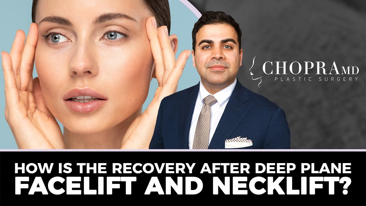 Quick Recovery after Deep Plane Facelift and Deep Neck Lift