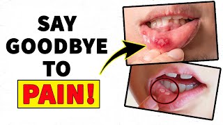 Stop Mouth Pain Fast Canker Sore Home Treatment