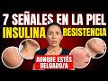 7 Señales en la Piel de Resistencia a la Insulina (Aunque Estés Delgado)