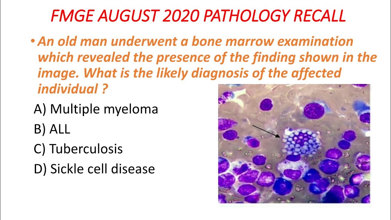 FMGE AUGUST 2020 EXAM _ PATHOLOGY FMGE RECALL MCQ  _ Image Based Question _ IBQ