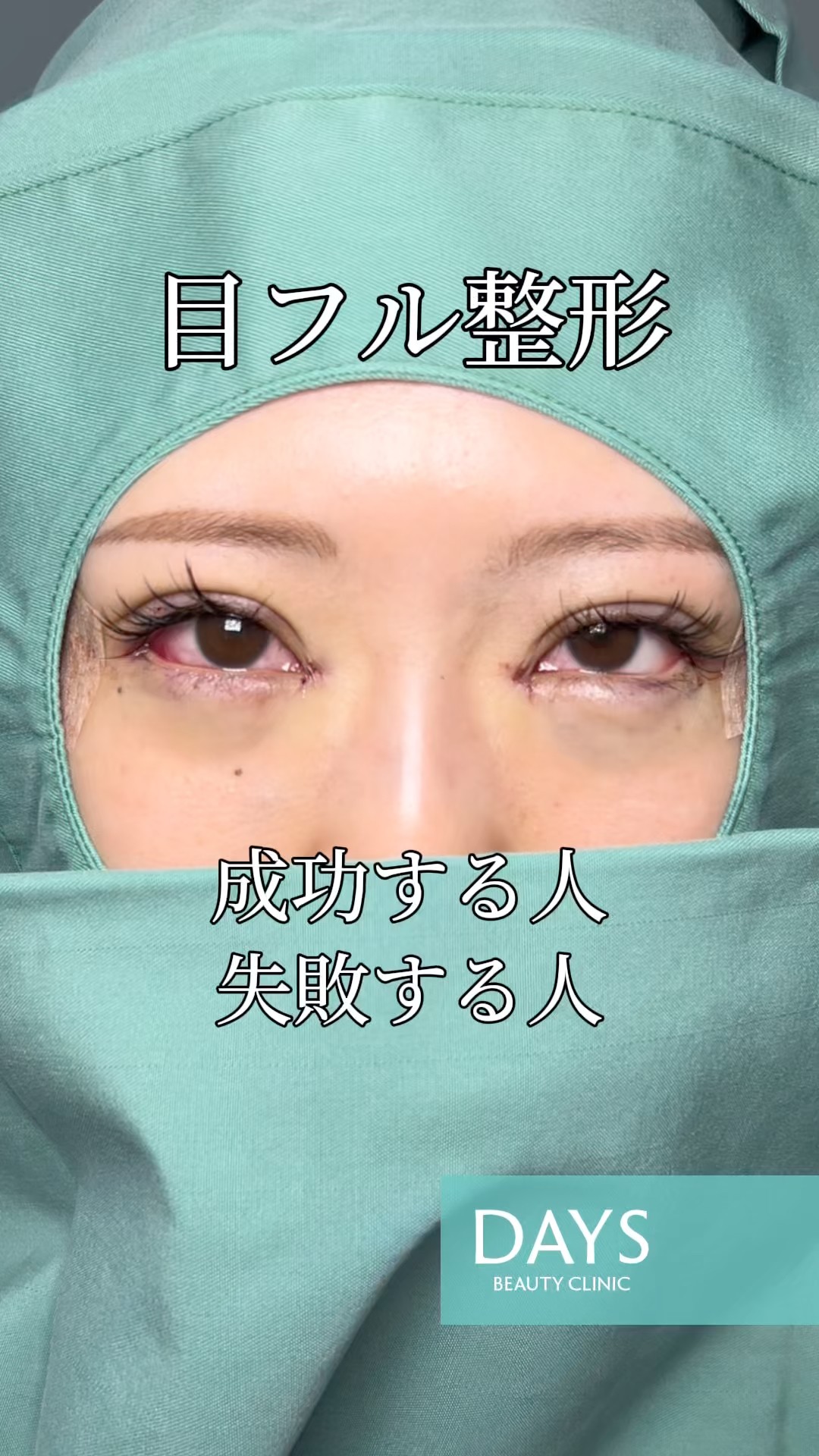 Double Eyelid Surgery] Who Succeeds and Who Fails at Full Eye