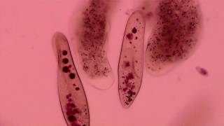 Amoeba extends pseudopods to capture its prey