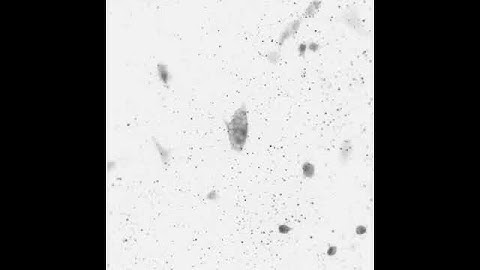 Ca image (Fura-2 AM)