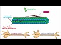 Alzheimer's Disease - plaques, tangles, pathogenesis, risk factors, disease progression