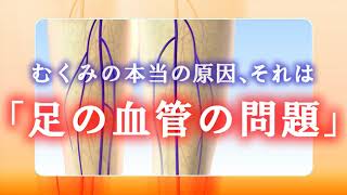 「むくみ難民」対策　ベノサン弾性ストッキング