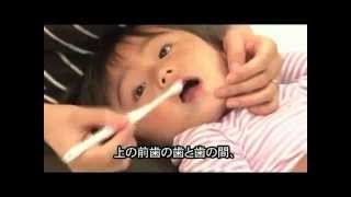 コンビ teteo仕上げみがき用歯ブラシ【虫歯になりやすいところ編】