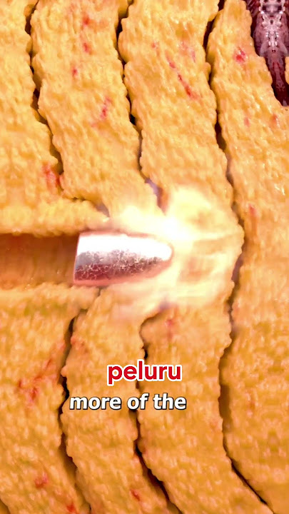 Anunya di tembak