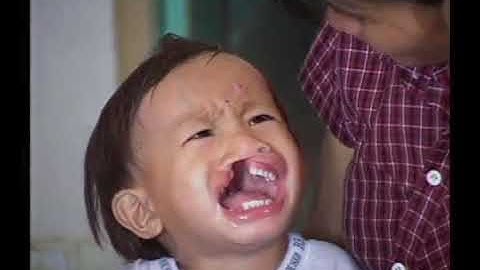 Operation Smile Honduras