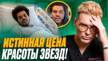 ВОТ что сделали с собой ЗВЕЗДЫ Голливуда: The Weeknd, Kanye West, Сильвестр Сталлоне, Зак Эфрон