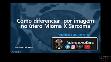 O que vem a ser hormonioterapia no tratamento em oncologia como vem sendo utilizada a hormonioterapia para sarcoma de útero?