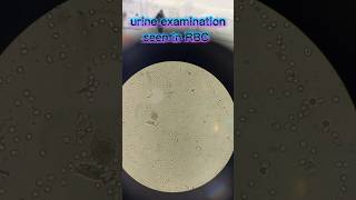 Urine | examination | in | microscope 🔬🔬🧪🥼 #doctor #tranding #urinalysis #microscope