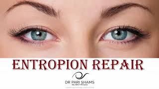 Entropion Repair At Pari Shams