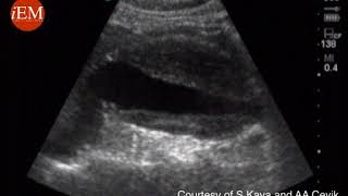 Information 65   AAA US longutudinal view Update