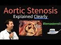 Aortic Stenosis Remastered (Symptoms, murmur, aortic valve stenosis treatment)