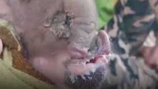 Mutant piglet born with 'elephant trunk'