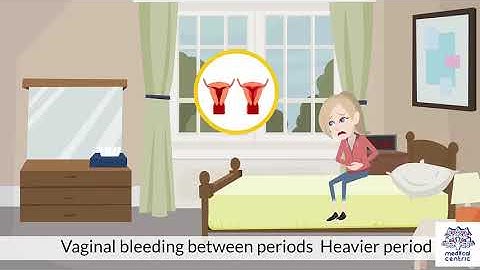 Gonorrhea, Causes, Signs and Symptoms, Diagnosis and Treatment.