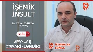 Isemik Insult - Nevroloq Vuqar Kerimov Istanbul Ns Klinikasi Medplustv