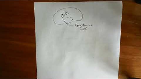 Gabapentin and Pregabalin Part 1