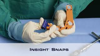 TrackX Snap Assembly Guide: Proper Mounting for Reliable Tracking