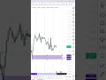 EURUSD 1H Timeframe Analysis Forex trading |EU buy setup