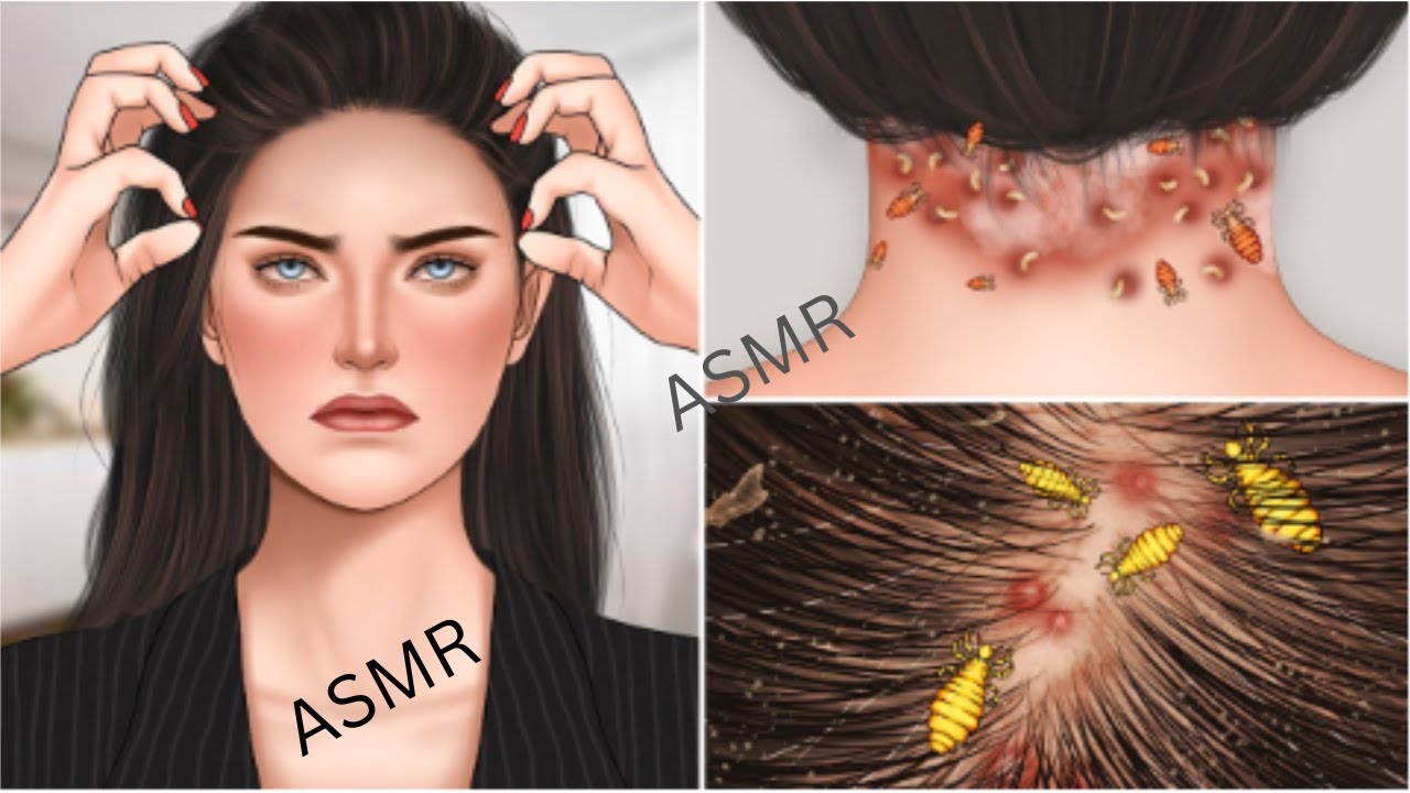 ASMR Athlete's foot toenails treatment animation 