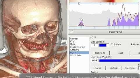 Visibility Histograms and Visibility-driven Transfer Functions