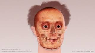 Alberto di Trento - Facial reconstruction using Manchester method and free software