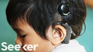 How Do Cochlear Implants Work?