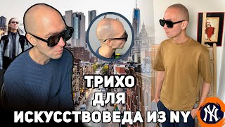 Трихопигментация в Москве. Тату волос при большой степени облысения. Scalp Micropigmentation.