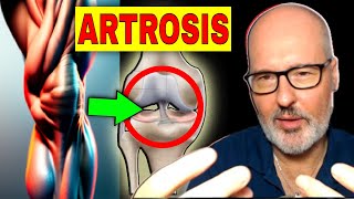 ARTHROSIS 💥 SYMPTOMS, CAUSES AND TREATMENT