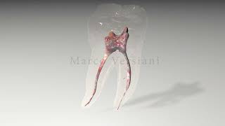 Mandibular First Molar - Prof Marco Versiani