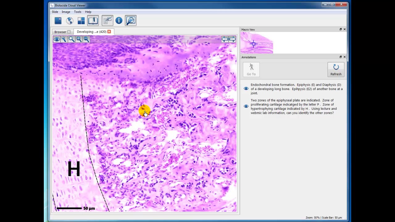 Module 2 Developing Bone - YouTube