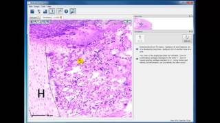 Module 2 Developing Bone