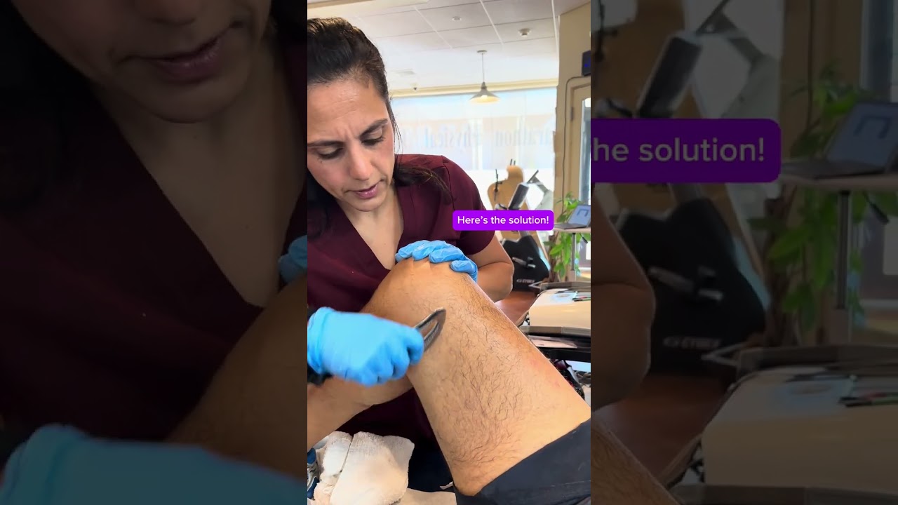 Marathon PT | IASTM for Tight Quads