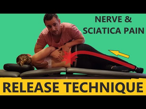 Video: Ako Dlho Vydrží Sciatica? Plus Tipy Na Správu Príznakov