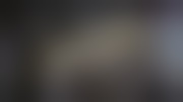 Abdomen Module I Practical 3 I Station (1): General Features of Small Intestine