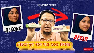 মাত্র ৫০০ টাকায় মেছতা কমানোর গোপন ট্রিটমেন্ট | Melatrin + Sunmask | Skin Point| Dr Shoeb official  screenshot 2