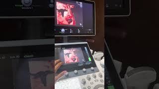 Erik Fernando González Martínez-18