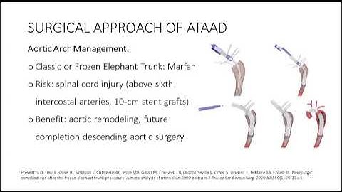 Hội chứng ĐMC cấp, điều trị nội khoa, điều trị ngoại khoa hiện nay, cập nhật mới điều trị phẩu thuật
