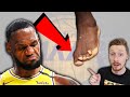 Why does Lebron James run funny?