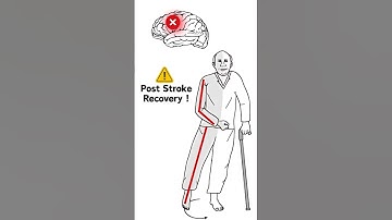 The Hidden Helper for Stroke recovery.