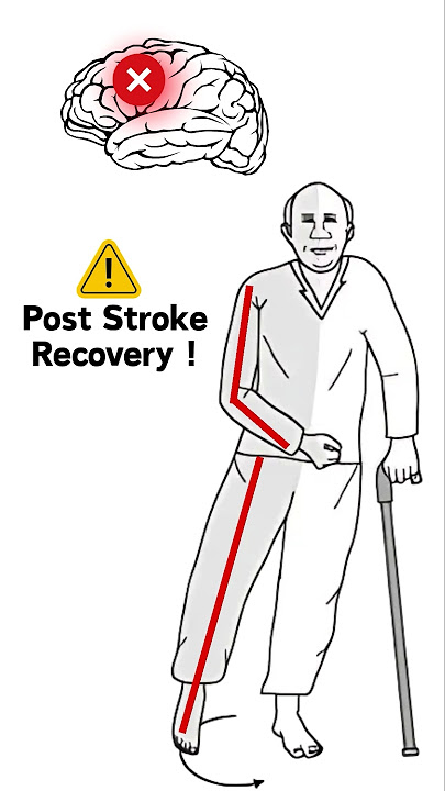 The Hidden Helper for Stroke recovery.
