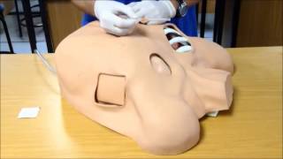 Needle Decompression Of The Chest