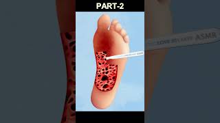 ASMR Remove Maggots from foot Animation | Love Relaxer ASMR youtubeshorts shorts asmranimation