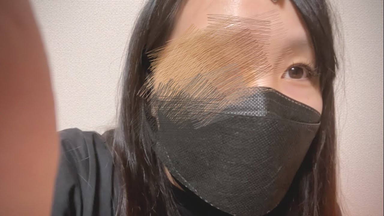 【閲覧注意】怪我しました