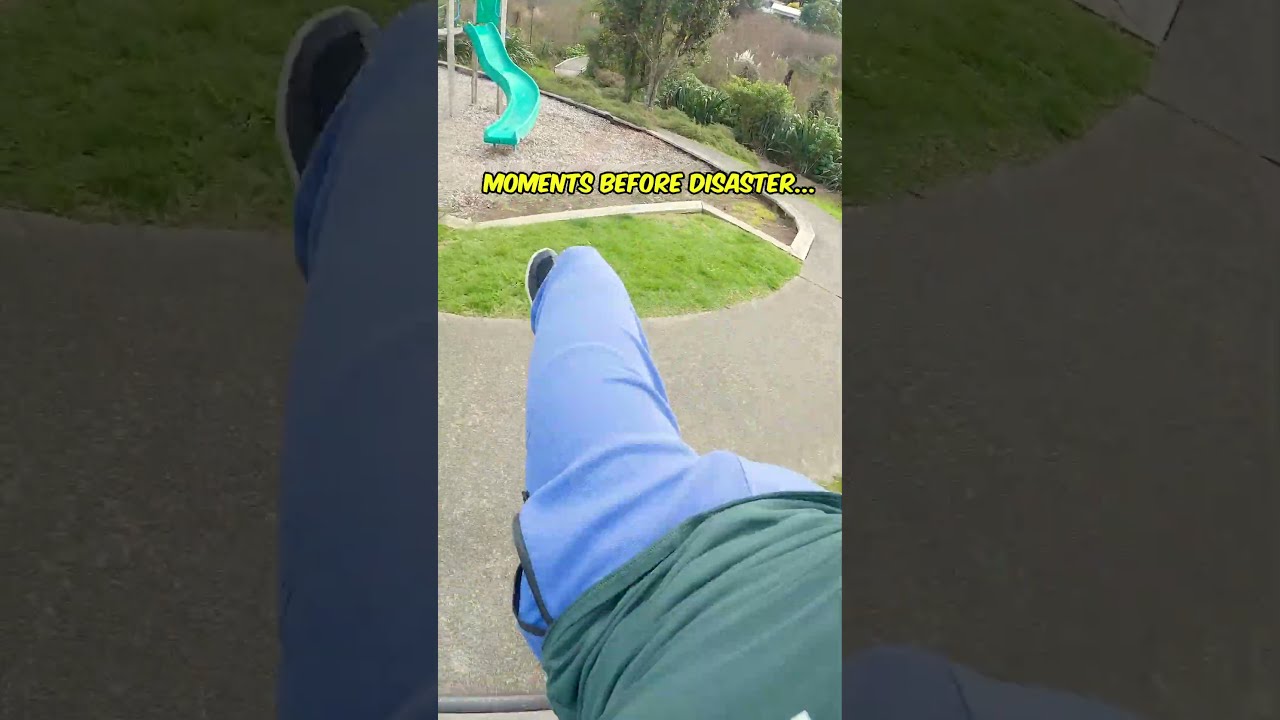 I BROKE MY ANKLE Fail Shorts