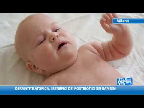 Video: Vernix Caseosa: Benefici Per Il Bambino