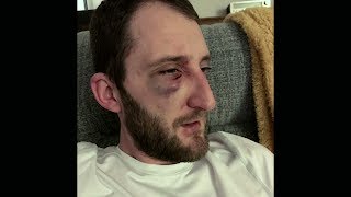 Police Code Zero: Officer Under Attack